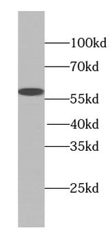TTC31 Rabbit Polyclonal Antibody