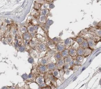 TTC31 Rabbit Polyclonal Antibody