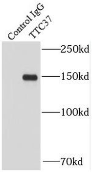 SKIC3 Rabbit Polyclonal Antibody