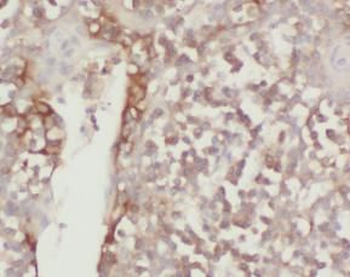 SKIC3 Rabbit Polyclonal Antibody