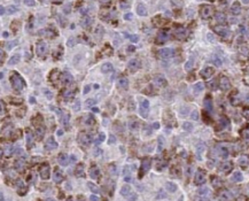 TTL Mouse Monoclonal Antibody