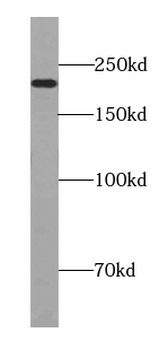 TSC2 Specific Rabbit Polyclonal Antibody
