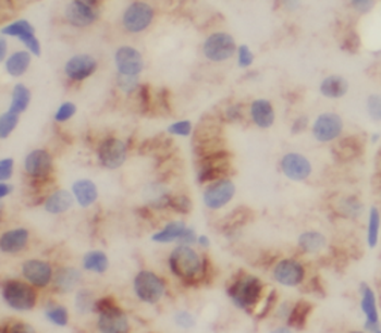 TSC2 Specific Rabbit Polyclonal Antibody