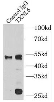 NXNL1 Rabbit Polyclonal Antibody