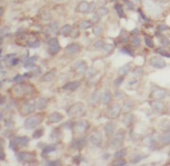 NXNL1 Rabbit Polyclonal Antibody
