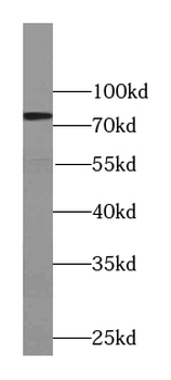 TYW1B Rabbit Polyclonal Antibody