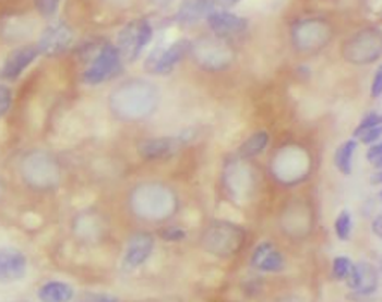 TYW1B Rabbit Polyclonal Antibody