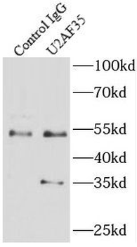 U2AF1 Mouse Monoclonal Antibody