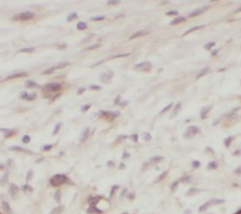 U2AF2 Rabbit Polyclonal Antibody