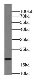 UBE2I Antibody