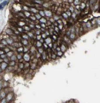 UBN1 Specific Rabbit Polyclonal Antibody