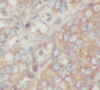 UBXN6 Rabbit Polyclonal Antibody