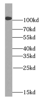 UNC5C Antibody