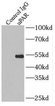 PLAUR Rabbit Polyclonal Antibody