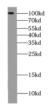USP1 Mouse Monoclonal Antibody