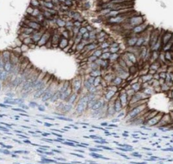 USP1 Mouse Monoclonal Antibody