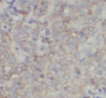 VAPB Mouse Monoclonal Antibody
