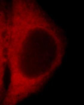 WDR81 Rabbit Polyclonal Antibody