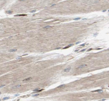 XIRP2 Rabbit Polyclonal Antibody