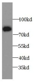 ALOX15B Antibody