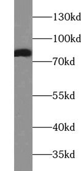 AACS Antibody