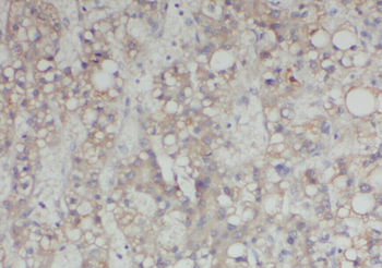 AADAT Rabbit Polyclonal Antibody