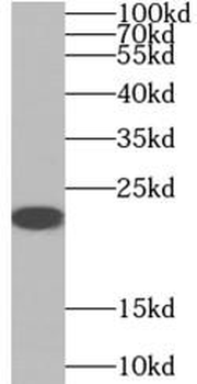 AANAT Antibody