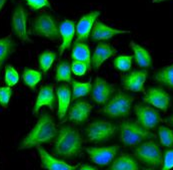 ABAT Antibody