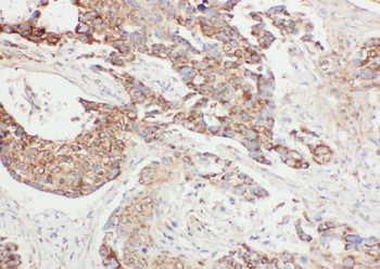 ABCD1 Rabbit Polyclonal Antibody