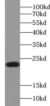 ABHD14B Rabbit Polyclonal Antibody