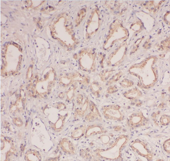 ABHD14B Rabbit Polyclonal Antibody