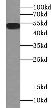 ABHD15 Antibody