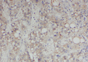ABL2 Rabbit Polyclonal Antibody