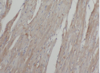 ABLIM2 Rabbit Polyclonal Antibody