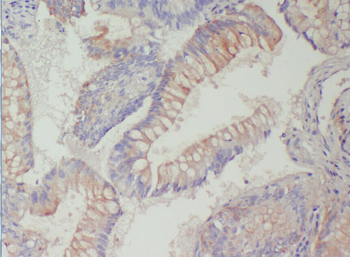 ACAD9 Rabbit Polyclonal Antibody