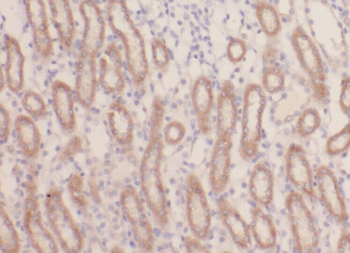 ACADL Rabbit Polyclonal Antibody