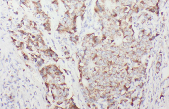 ACADSB Rabbit Polyclonal Antibody