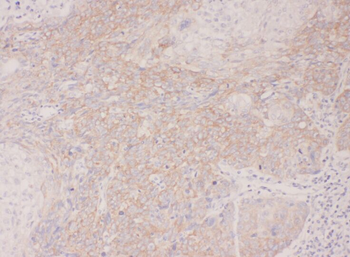 ACAP1 Rabbit Polyclonal Antibody