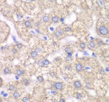 ACAT1 Rabbit Polyclonal Antibody