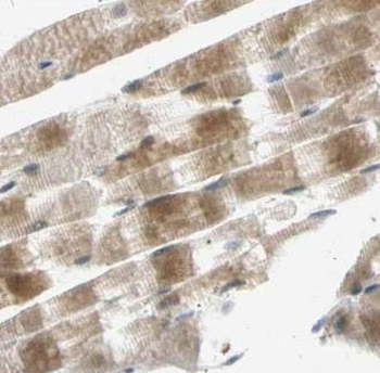 ACACA Rabbit Polyclonal Antibody
