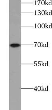 TNK2 Rabbit Polyclonal Antibody