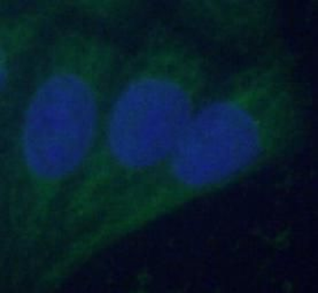 ACO2 Antibody