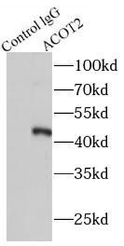 ACOT2 Rabbit Polyclonal Antibody