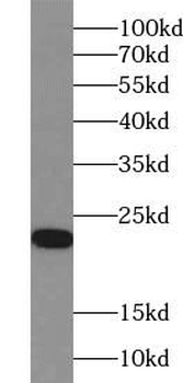 ACOT6 Antibody