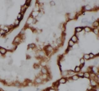 ACOT6 Rabbit Polyclonal Antibody