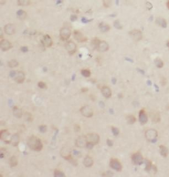 ACOT7 Rabbit Polyclonal Antibody