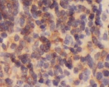 ACOXL Rabbit Polyclonal Antibody