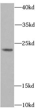 ACP1 Antibody