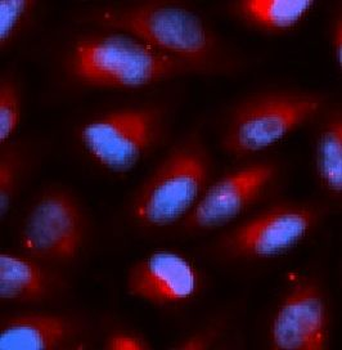 ACP5 Antibody