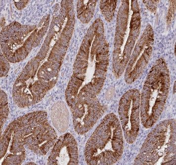 ACSF2 Rabbit Polyclonal Antibody